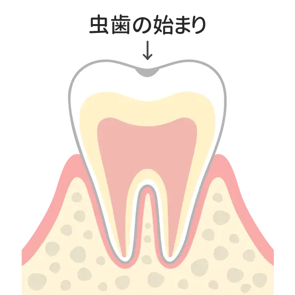 C0（初期）