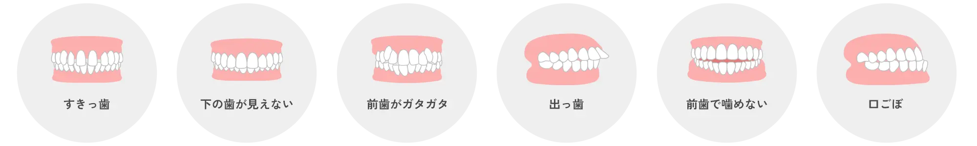 不正咬合