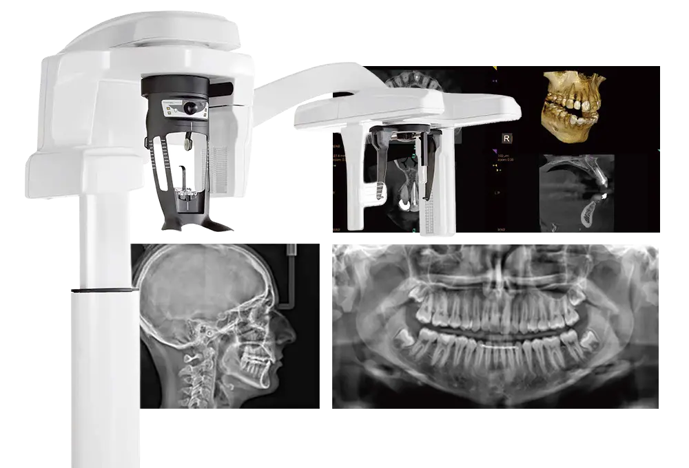 「セファロ機能」付き歯科用CT
